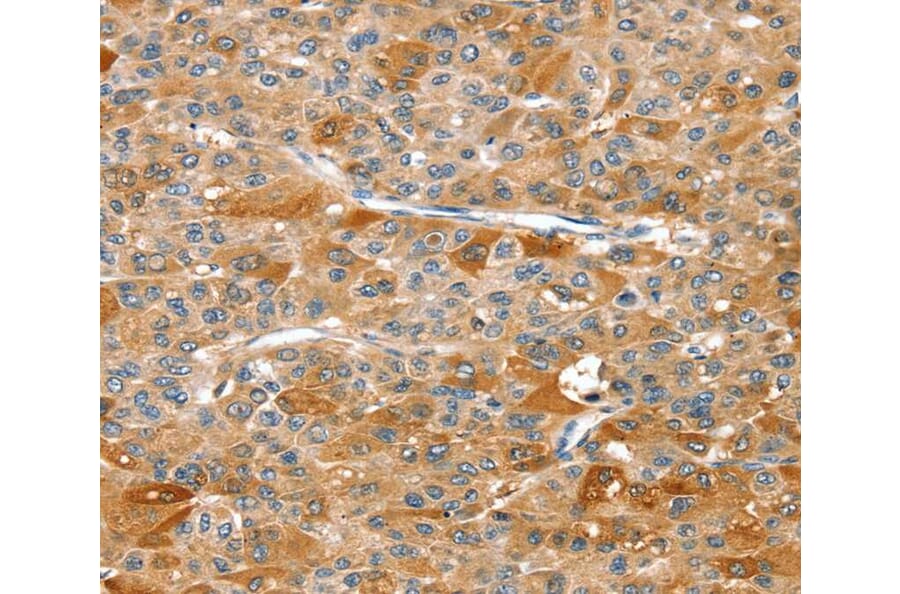 Immunohistochemistry - DSTYK Antibody from Signalway Antibody (40322) - Antibodies.com