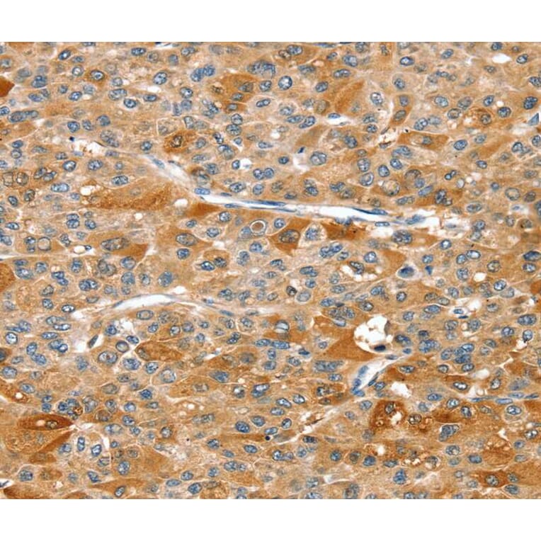 Immunohistochemistry - DSTYK Antibody from Signalway Antibody (40322) - Antibodies.com