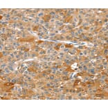 Immunohistochemistry - DSTYK Antibody from Signalway Antibody (40322) - Antibodies.com