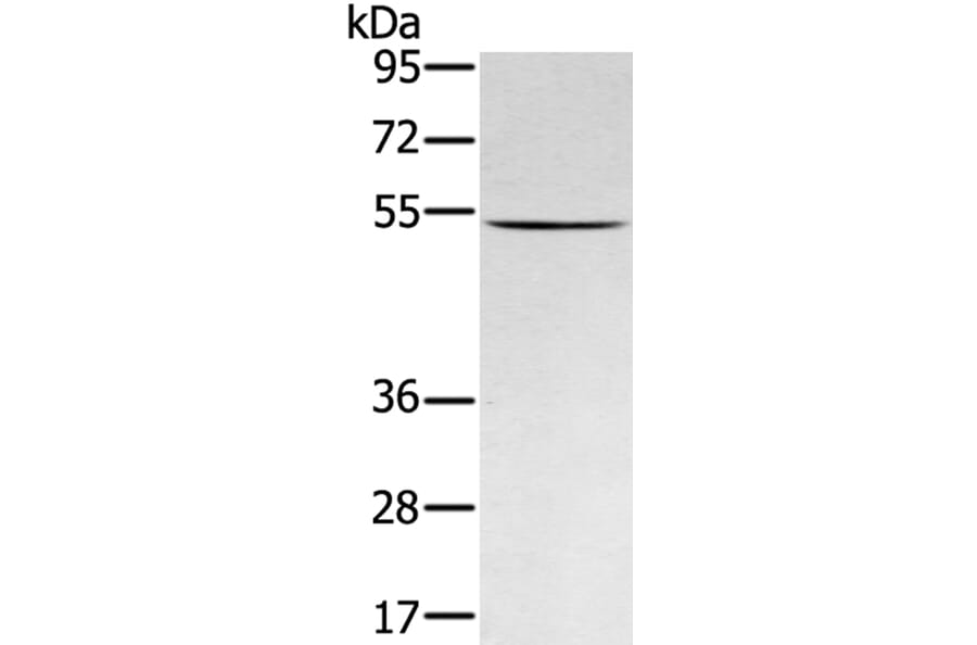 RNF14 Antibody from Signalway Antibody (40324) - Antibodies.com