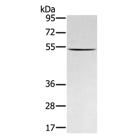 RNF14 Antibody from Signalway Antibody (40324) - Antibodies.com