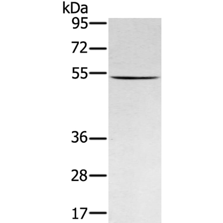 RNF14 Antibody from Signalway Antibody (40324) - Antibodies.com