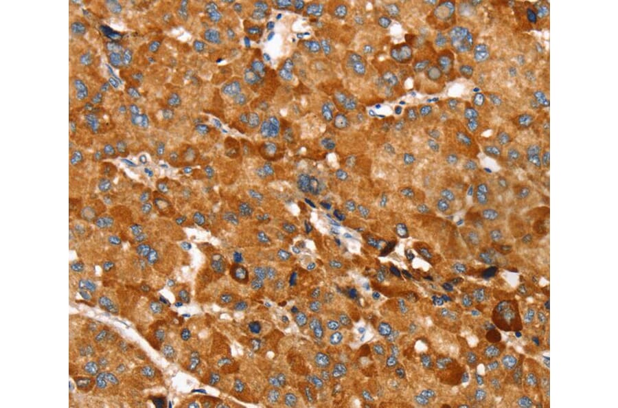 Immunohistochemistry - RNF14 Antibody from Signalway Antibody (40324) - Antibodies.com