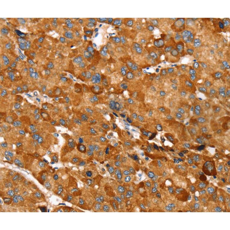 Immunohistochemistry - RNF14 Antibody from Signalway Antibody (40324) - Antibodies.com