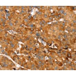 Immunohistochemistry - RNF14 Antibody from Signalway Antibody (40324) - Antibodies.com