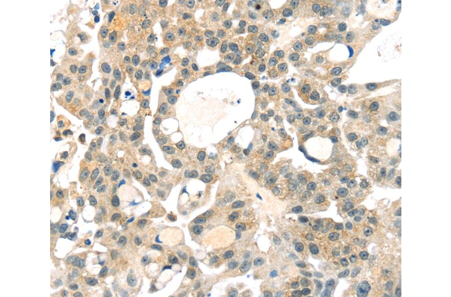 Immunohistochemistry - RRAGA Antibody from Signalway Antibody (40326) - Antibodies.com