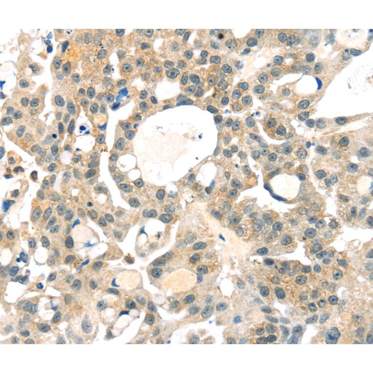 Immunohistochemistry - RRAGA Antibody from Signalway Antibody (40326) - Antibodies.com