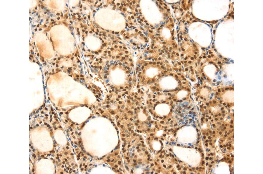 Immunohistochemistry - SAMD3 Antibody from Signalway Antibody (40330) - Antibodies.com
