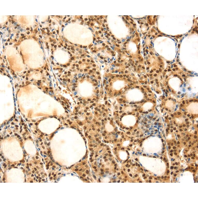 Immunohistochemistry - SAMD3 Antibody from Signalway Antibody (40330) - Antibodies.com