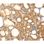 Immunohistochemistry - SAMD3 Antibody from Signalway Antibody (40330) - Antibodies.com