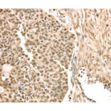 Immunohistochemistry - SAMD3 Antibody from Signalway Antibody (40330) - Antibodies.com
