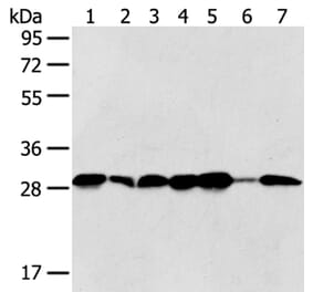 SRPRB Antibody from Signalway Antibody (40333) - Antibodies.com