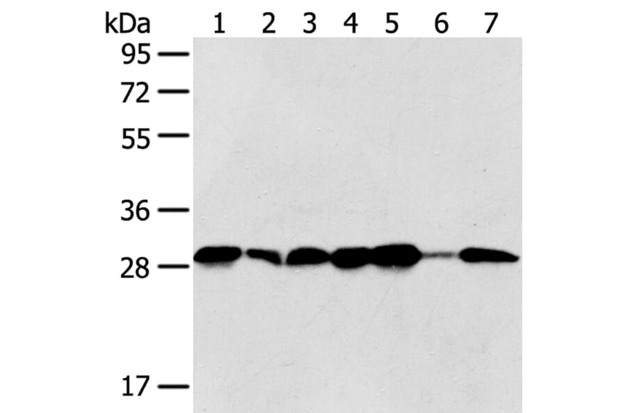 SRPRB Antibody from Signalway Antibody (40333) - Antibodies.com