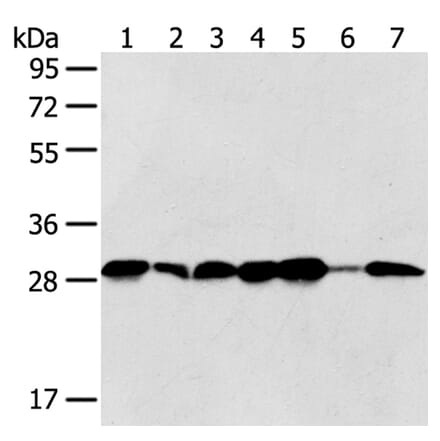 SRPRB Antibody from Signalway Antibody (40333) - Antibodies.com