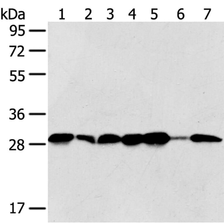 SRPRB Antibody from Signalway Antibody (40333) - Antibodies.com