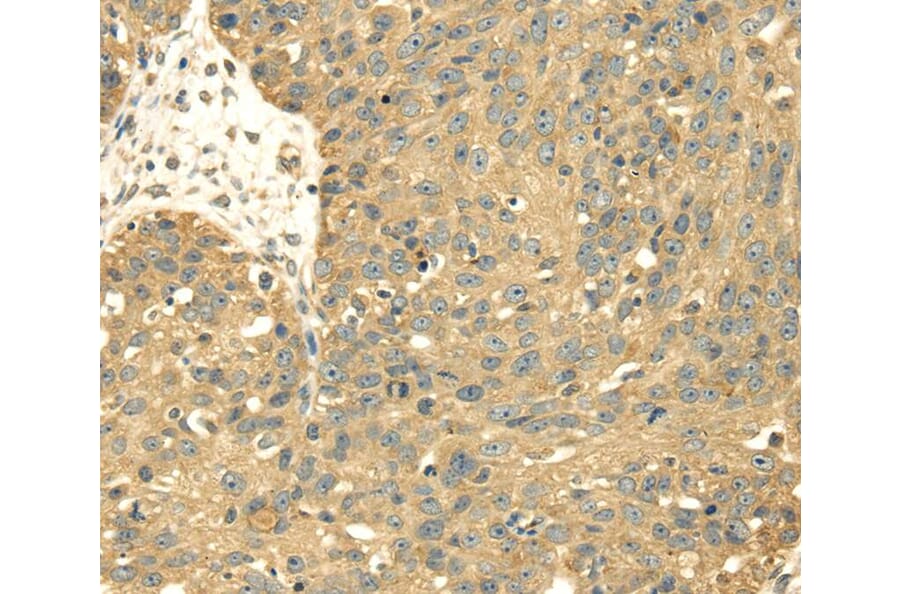 Immunohistochemistry - SRPRB Antibody from Signalway Antibody (40333) - Antibodies.com
