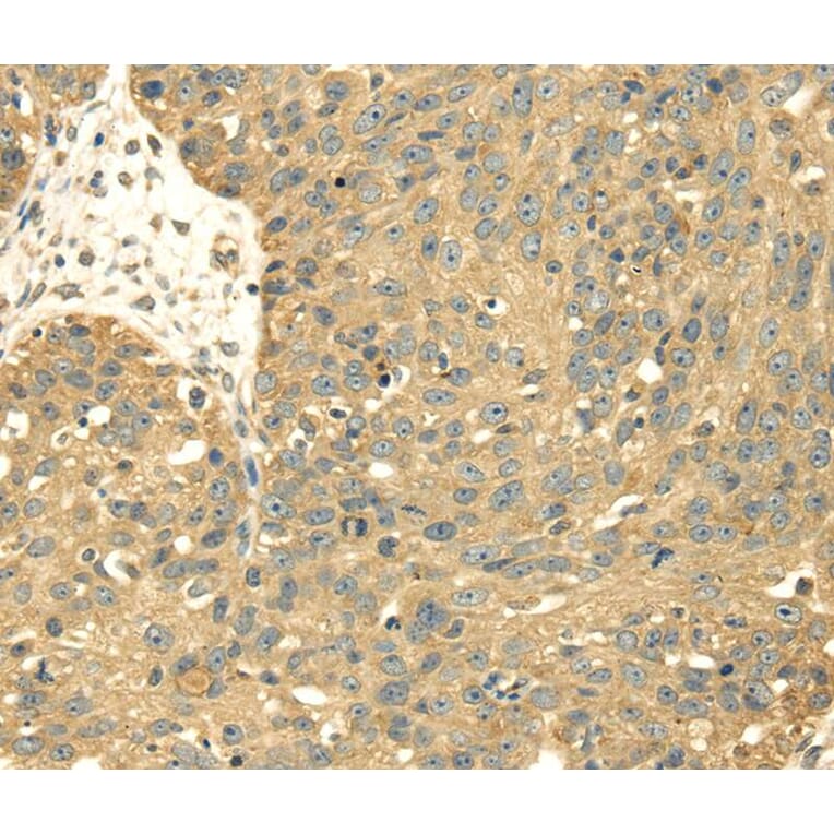 Immunohistochemistry - SRPRB Antibody from Signalway Antibody (40333) - Antibodies.com