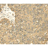 Immunohistochemistry - SRPRB Antibody from Signalway Antibody (40333) - Antibodies.com