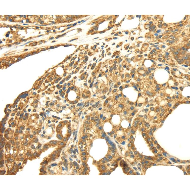 Immunohistochemistry - SRPRB Antibody from Signalway Antibody (40333) - Antibodies.com