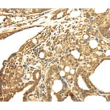 Immunohistochemistry - SRPRB Antibody from Signalway Antibody (40333) - Antibodies.com