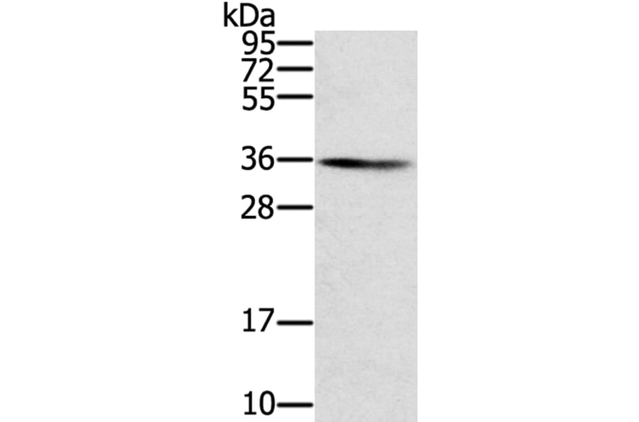 SNX11 Antibody from Signalway Antibody (40336) - Antibodies.com
