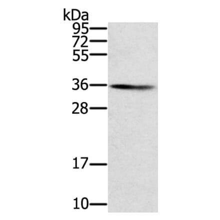 SNX11 Antibody from Signalway Antibody (40336) - Antibodies.com