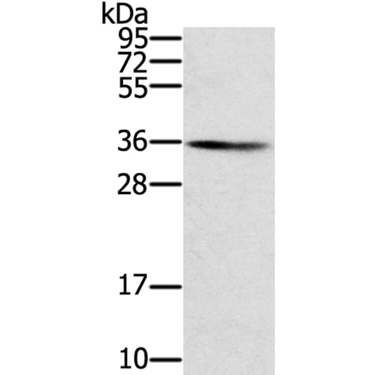SNX11 Antibody from Signalway Antibody (40336) - Antibodies.com