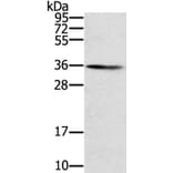 SNX11 Antibody from Signalway Antibody (40336) - Antibodies.com