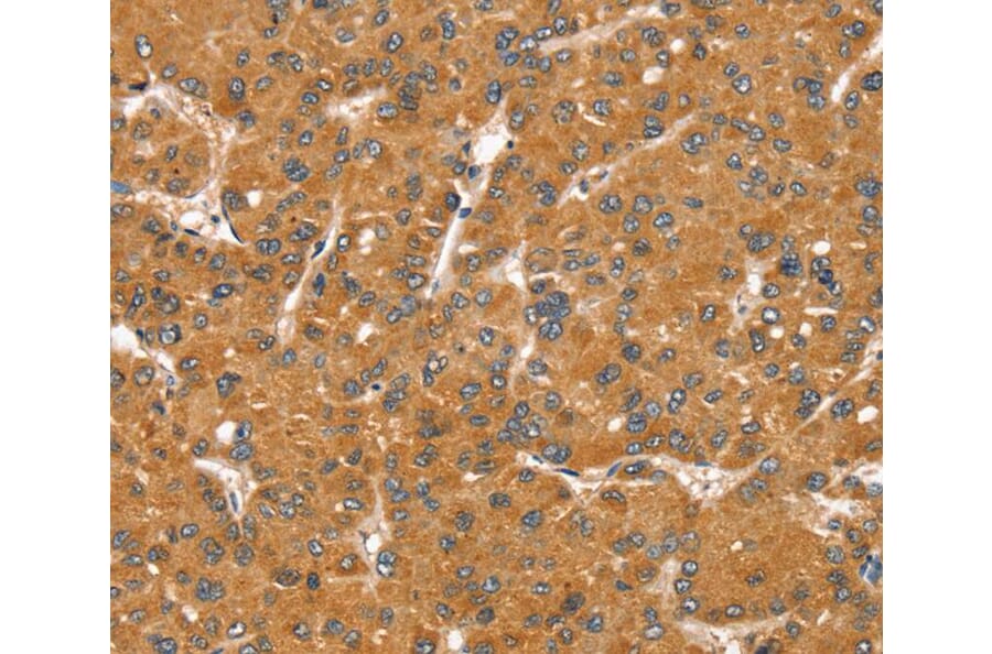 Immunohistochemistry - SNX11 Antibody from Signalway Antibody (40336) - Antibodies.com