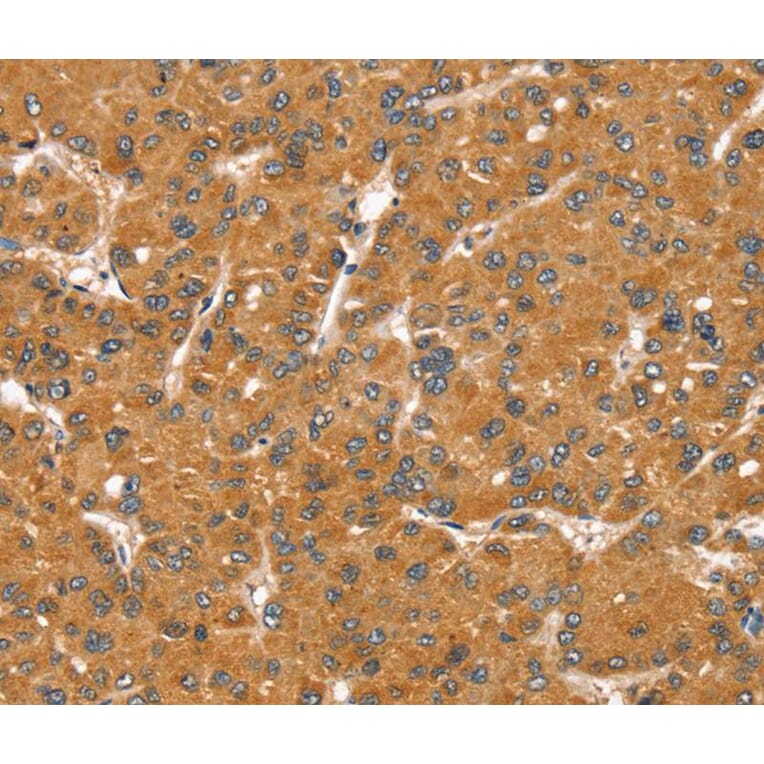 Immunohistochemistry - SNX11 Antibody from Signalway Antibody (40336) - Antibodies.com