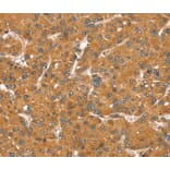 Immunohistochemistry - SNX11 Antibody from Signalway Antibody (40336) - Antibodies.com
