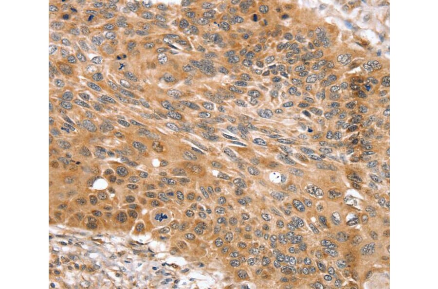 Immunohistochemistry - SNX11 Antibody from Signalway Antibody (40336) - Antibodies.com