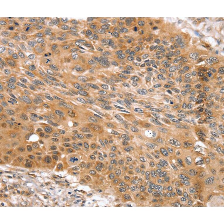 Immunohistochemistry - SNX11 Antibody from Signalway Antibody (40336) - Antibodies.com