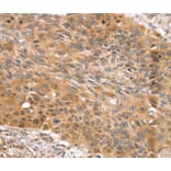 Immunohistochemistry - SNX11 Antibody from Signalway Antibody (40336) - Antibodies.com
