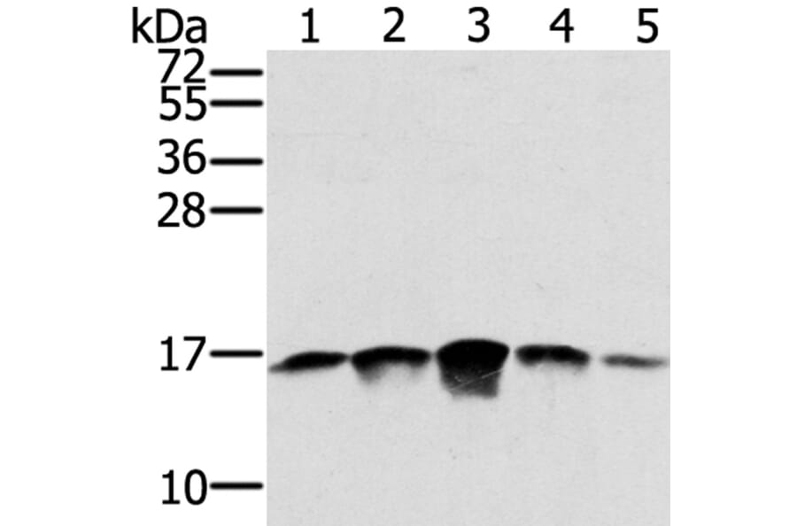 SSBP1 Antibody from Signalway Antibody (40338) - Antibodies.com