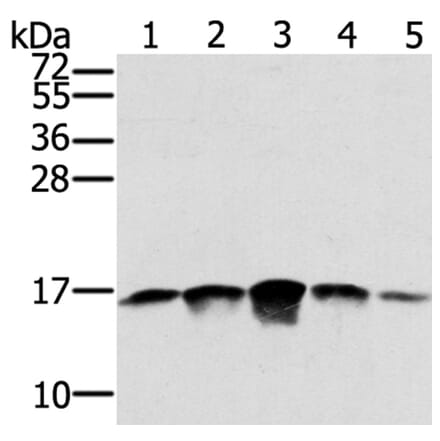 SSBP1 Antibody from Signalway Antibody (40338) - Antibodies.com