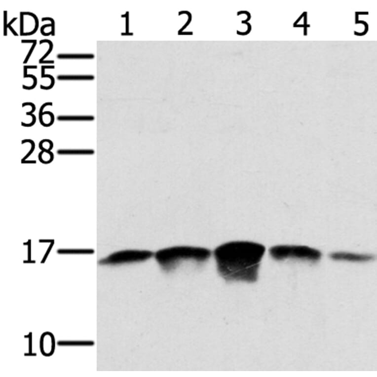 SSBP1 Antibody from Signalway Antibody (40338) - Antibodies.com