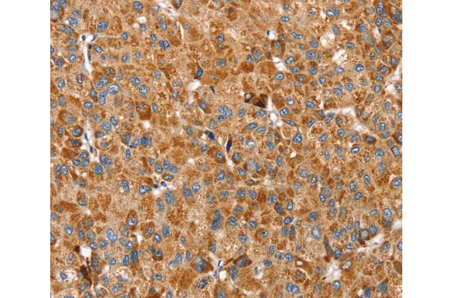Immunohistochemistry - SSBP1 Antibody from Signalway Antibody (40338) - Antibodies.com