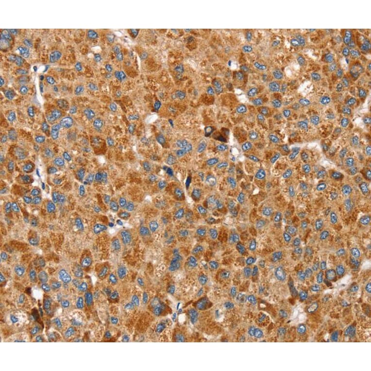 Immunohistochemistry - SSBP1 Antibody from Signalway Antibody (40338) - Antibodies.com