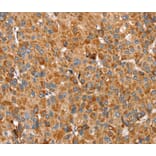 Immunohistochemistry - SSBP1 Antibody from Signalway Antibody (40338) - Antibodies.com