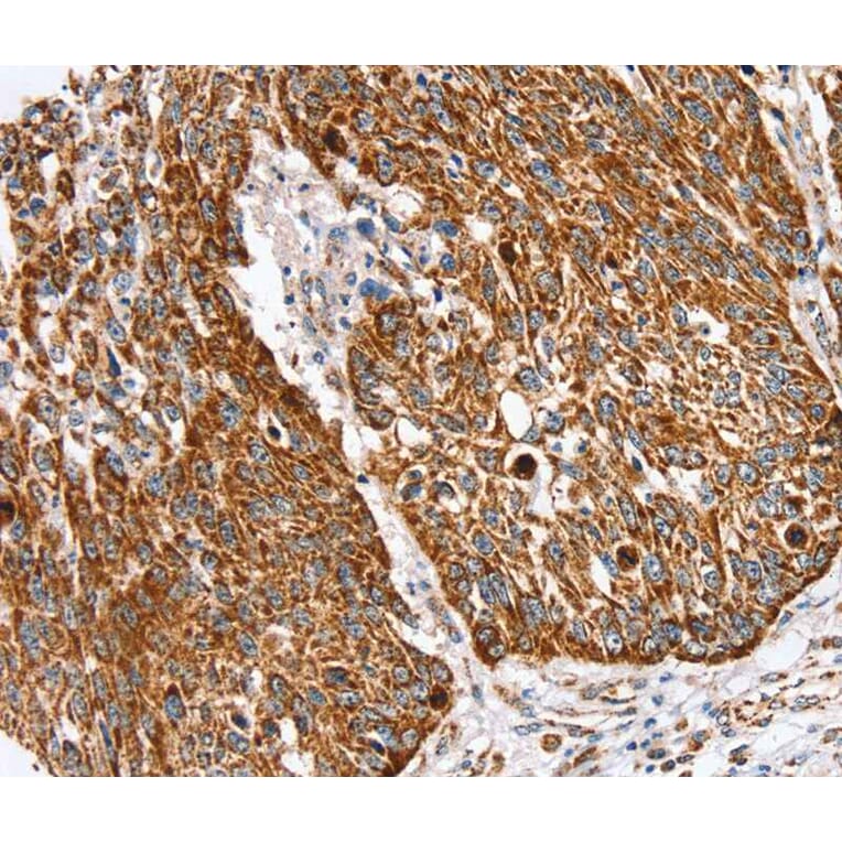 Immunohistochemistry - SSBP1 Antibody from Signalway Antibody (40338) - Antibodies.com