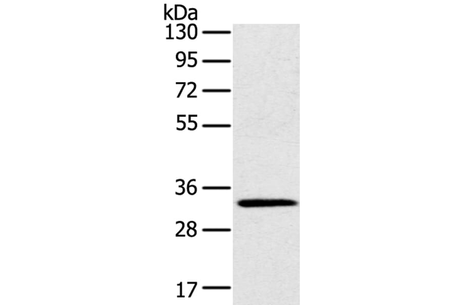STK16 Antibody from Signalway Antibody (40341) - Antibodies.com