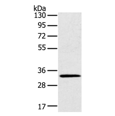 STK16 Antibody from Signalway Antibody (40341) - Antibodies.com