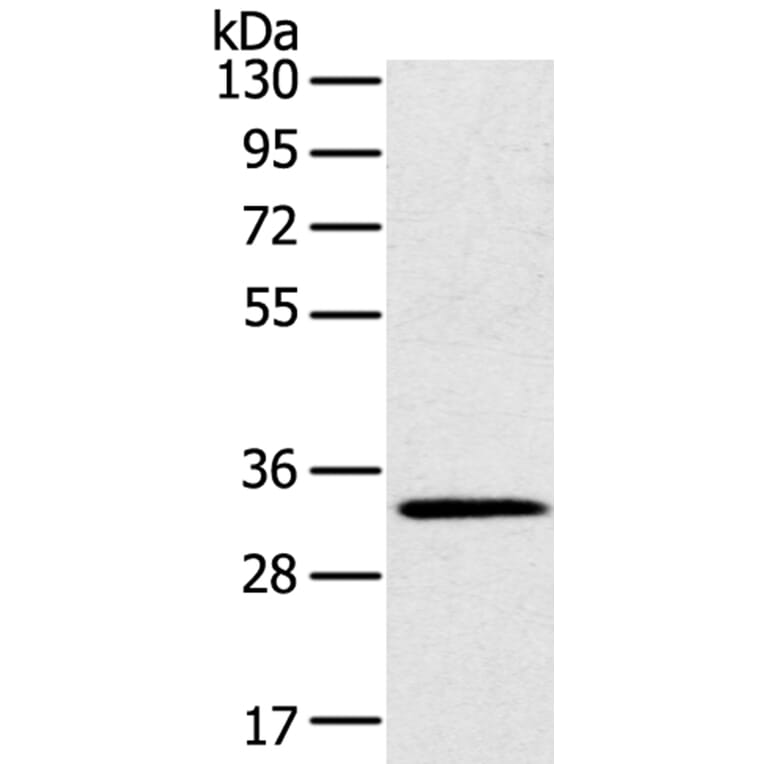 STK16 Antibody from Signalway Antibody (40341) - Antibodies.com