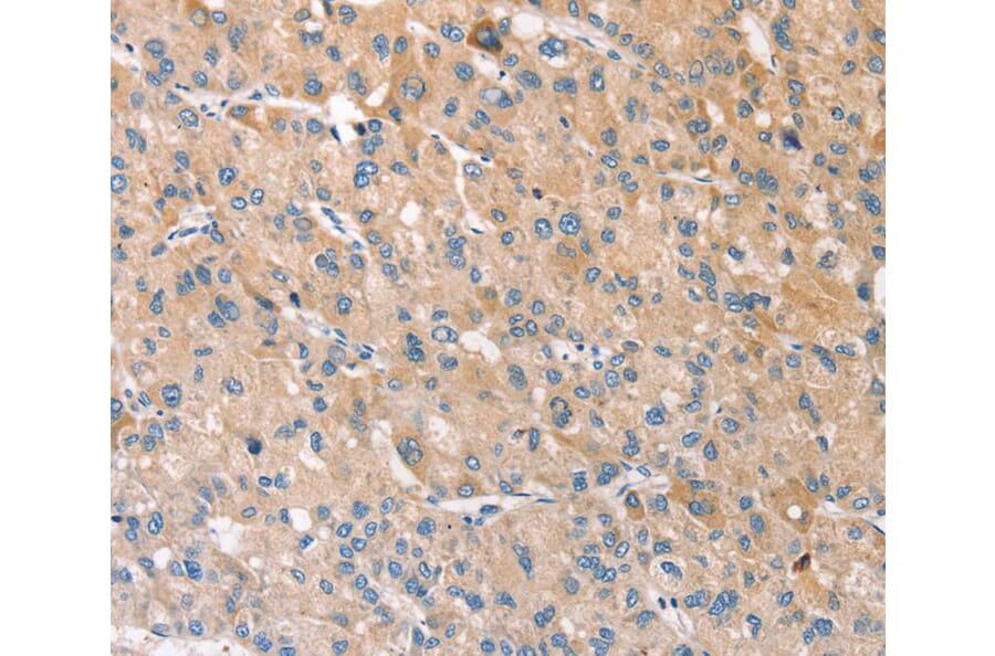 Immunohistochemistry - STK16 Antibody from Signalway Antibody (40341) - Antibodies.com