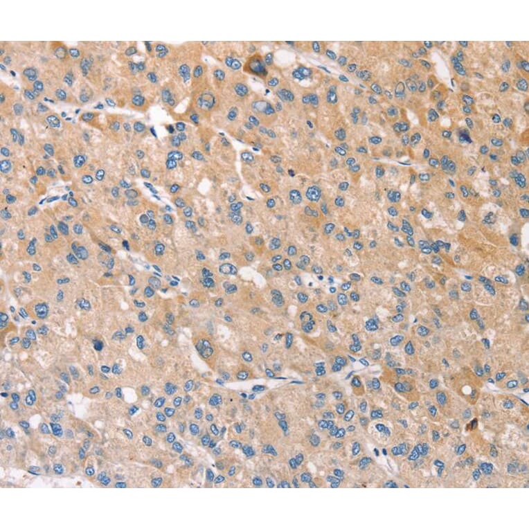 Immunohistochemistry - STK16 Antibody from Signalway Antibody (40341) - Antibodies.com