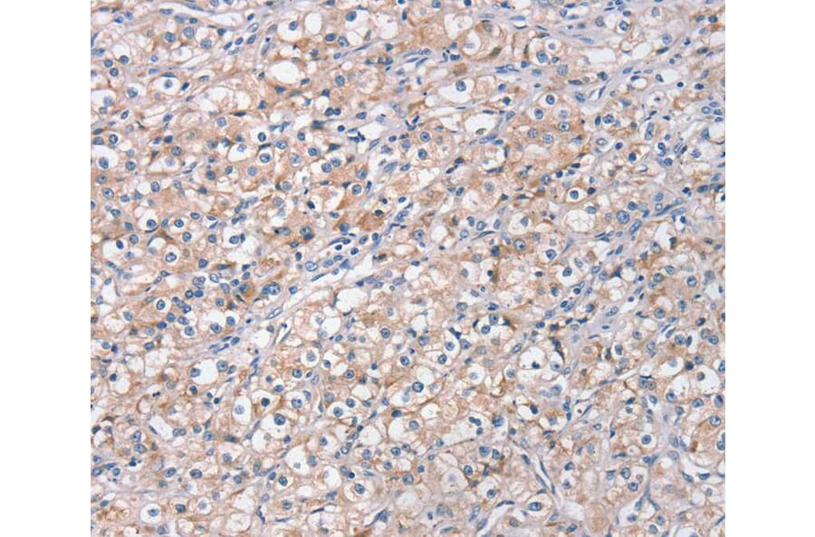 Immunohistochemistry - STK16 Antibody from Signalway Antibody (40341) - Antibodies.com