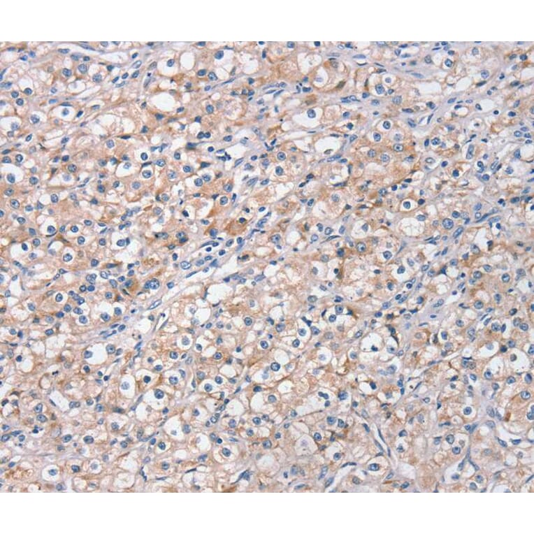 Immunohistochemistry - STK16 Antibody from Signalway Antibody (40341) - Antibodies.com