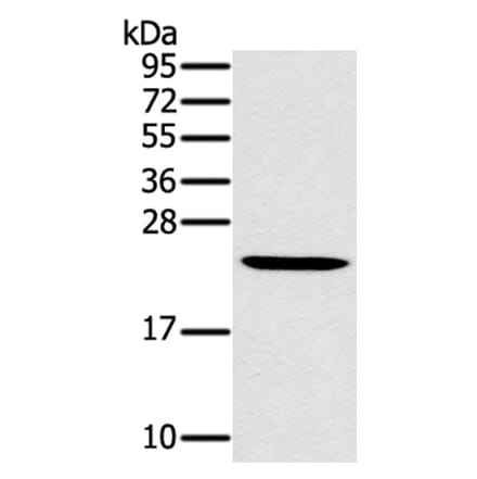 MED22 Antibody from Signalway Antibody (40342) - Antibodies.com