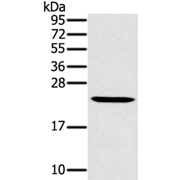 MED22 Antibody from Signalway Antibody (40342) - Antibodies.com